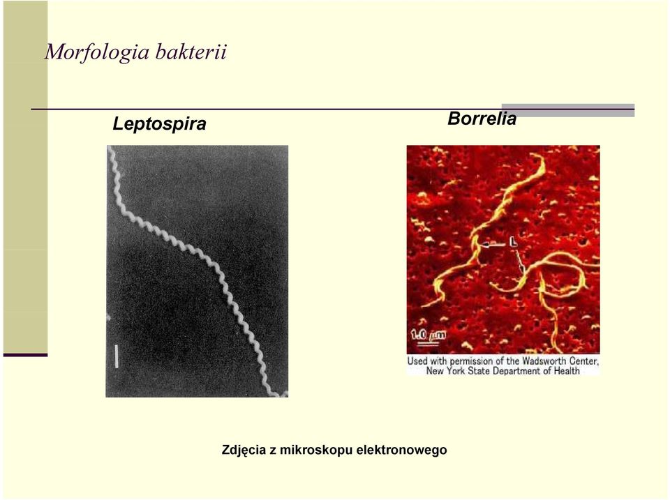 Leptospira