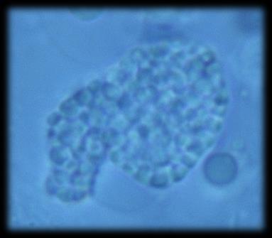 AGD (amoebic gill diseases)