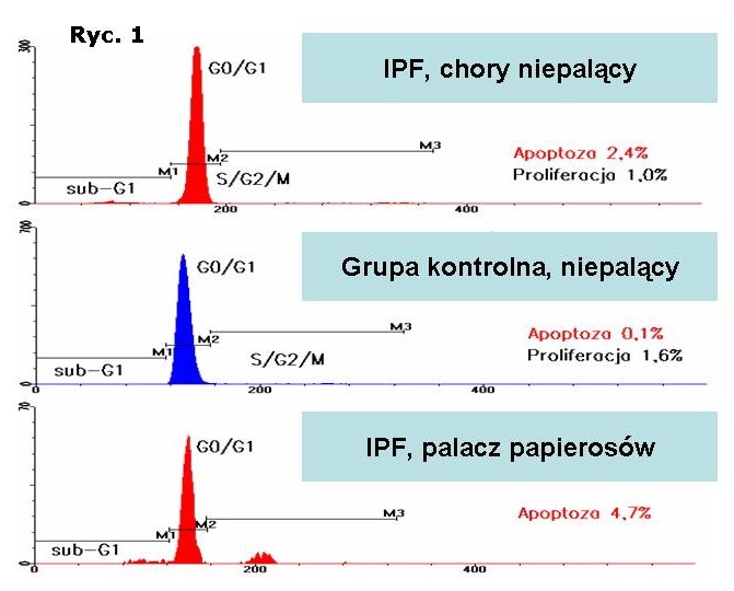 próbki kontrolne ze zgodnymi izotypowo przeciwcia³ami mysimi. Akwizycjê w cytometrze przep³ywowym BD FAC- SCalibur (laser argonowy 488 nm) wykonano zbieraj¹c dane, o co najmniej 10.