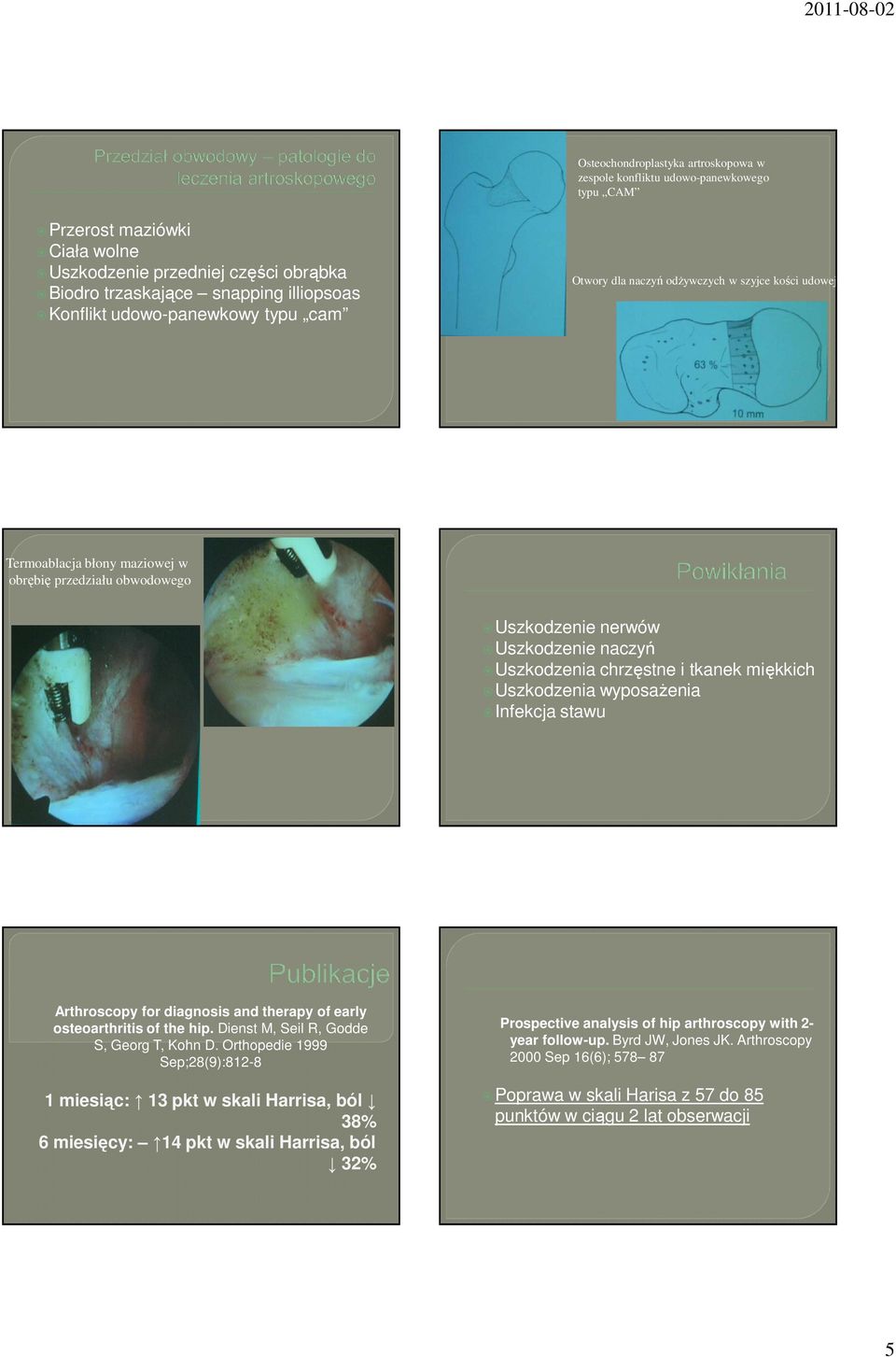 tkanek miękkich Uszkodzenia wyposażenia Infekcja stawu Arthroscopy for diagnosis and therapy of early osteoarthritis of the hip. Dienst M, Seil R, Godde S, Georg T, Kohn D.