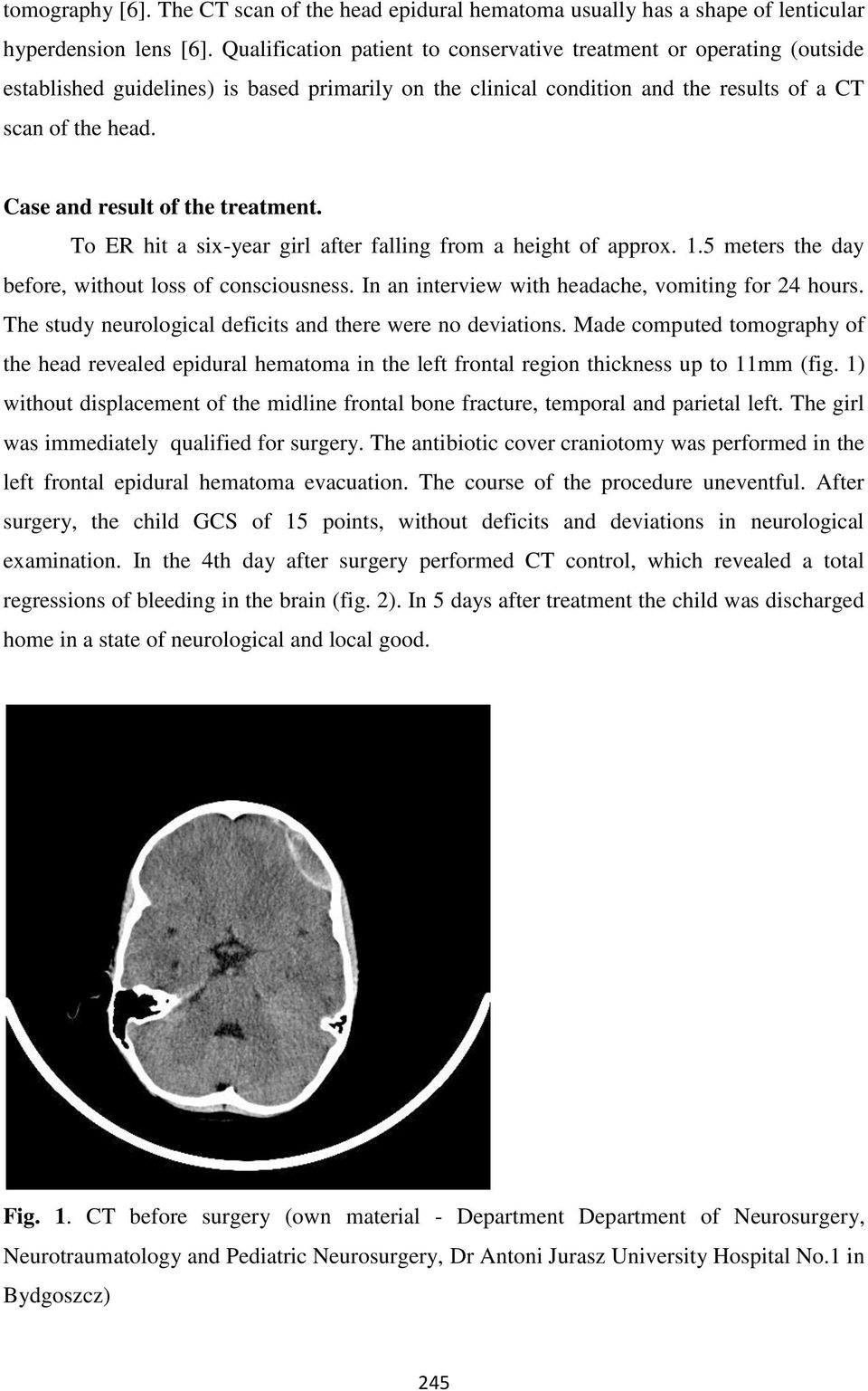 Case and result of the treatment. To ER hit a six-year girl after falling from a height of approx. 1.5 meters the day before, without loss of consciousness.
