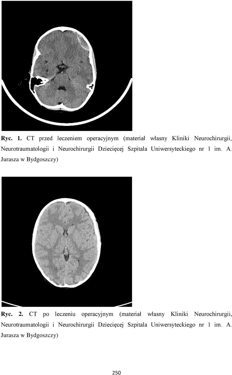 Neurochirurgii Dziecięcej Szpitala Uniwersyteckiego nr 1 im. A. Jurasza w Bydgoszczy) Ryc. 2.