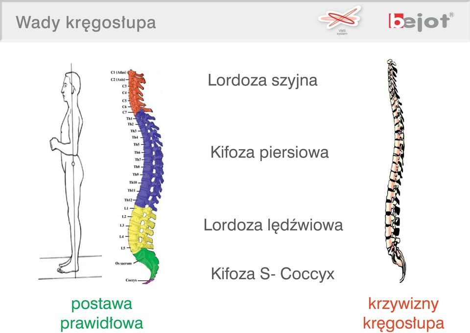 dêwiowa Kifoza S- Coccyx