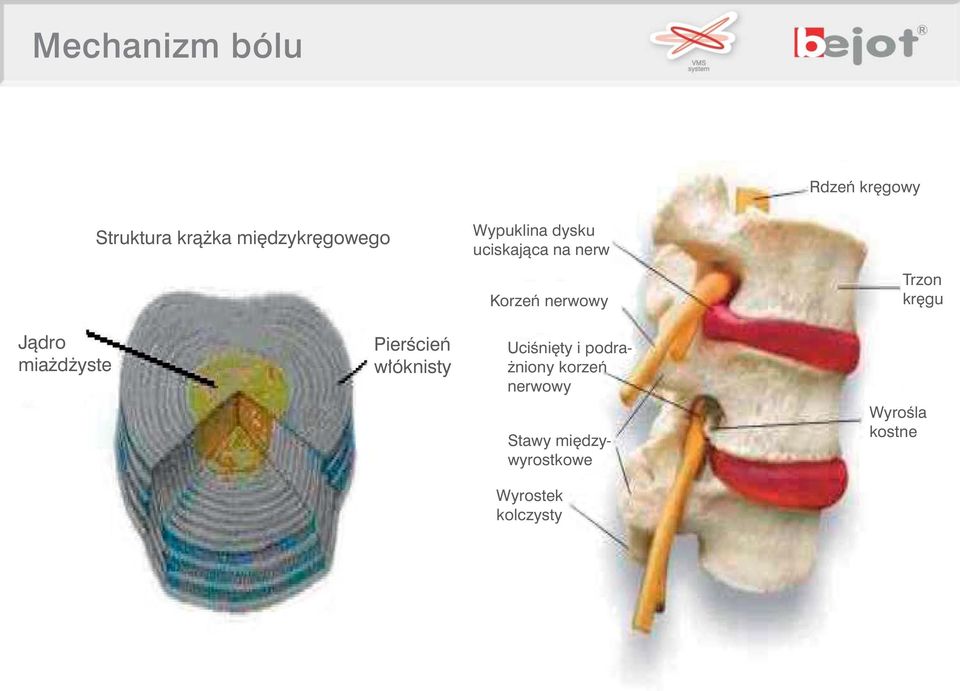Jàdro mia d yste PierÊcieƒ w óknisty UciÊni ty i podra- niony