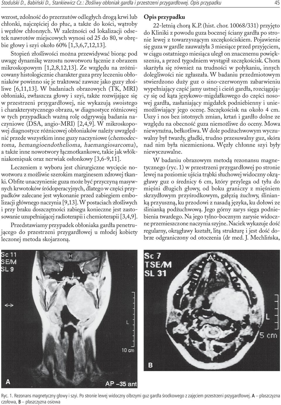 W zale noœci od lokalizacji odsetek nawrotów miejscowych wynosi od 25 do 80, w obrêbie g³owy i szyi oko³o 60% [1,3,6,7,12,13].