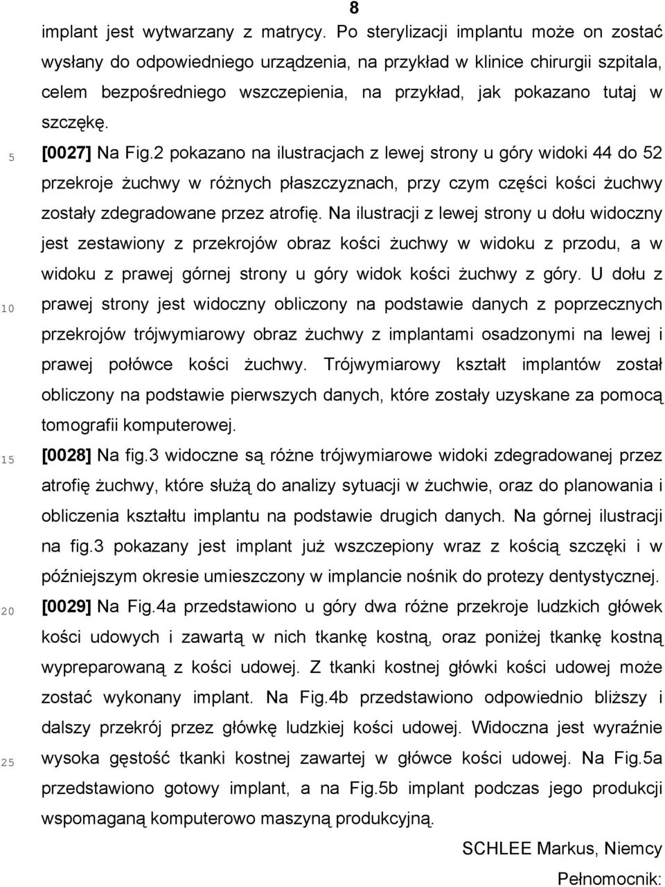 [0027] Na Fig.2 pokazano na ilustracjach z lewej strony u góry widoki 44 do 52 przekroje żuchwy w różnych płaszczyznach, przy czym części kości żuchwy zostały zdegradowane przez atrofię.