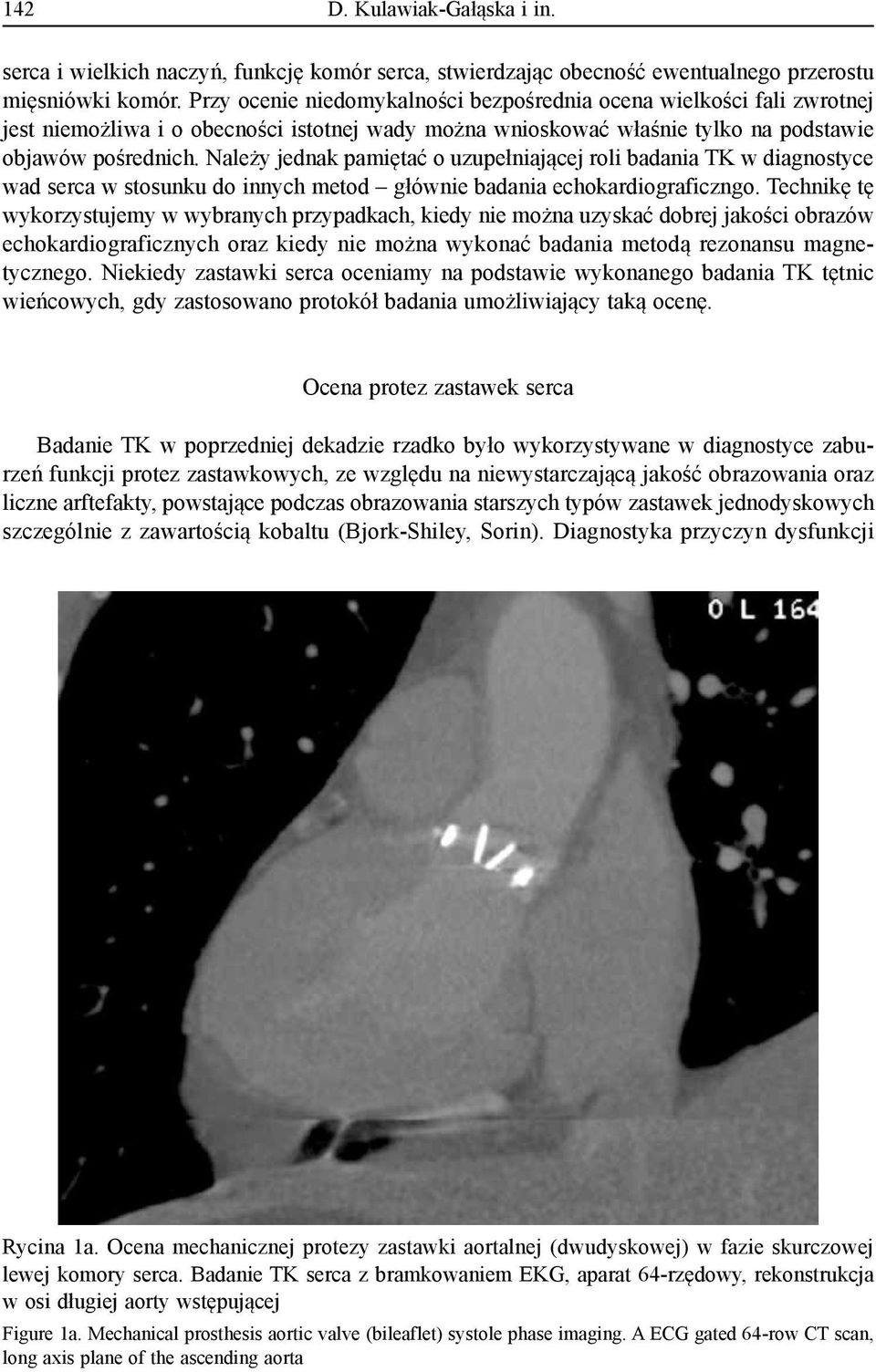 Należy jednak pamiętać o uzupełniającej roli badania TK w diagnostyce wad serca w stosunku do innych metod głównie badania echokardiograficzngo.