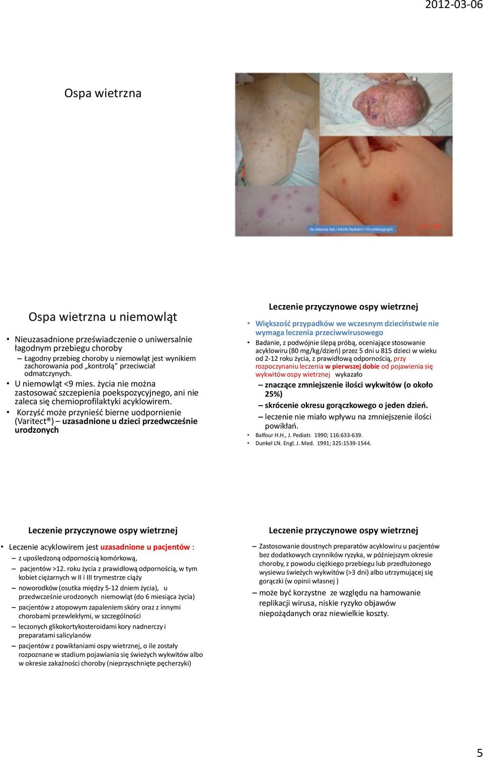 Korzyść może przynieść bierne uodpornienie (Varitect ) uzasadnione u dzieci przedwcześnie urodzonych Leczenie przyczynowe ospy wietrznej Większość przypadków we wczesnym dzieciństwie nie wymaga