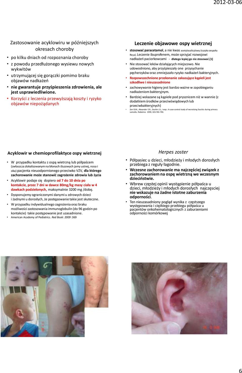 Korzyści z leczenia przewyższają koszty i ryzyko objawów niepożądanych Leczenie objawowe ospy wietrznej stosować paracetamol, a nie kwas acetylosalicylowy (ryzyko zespołu Reya).