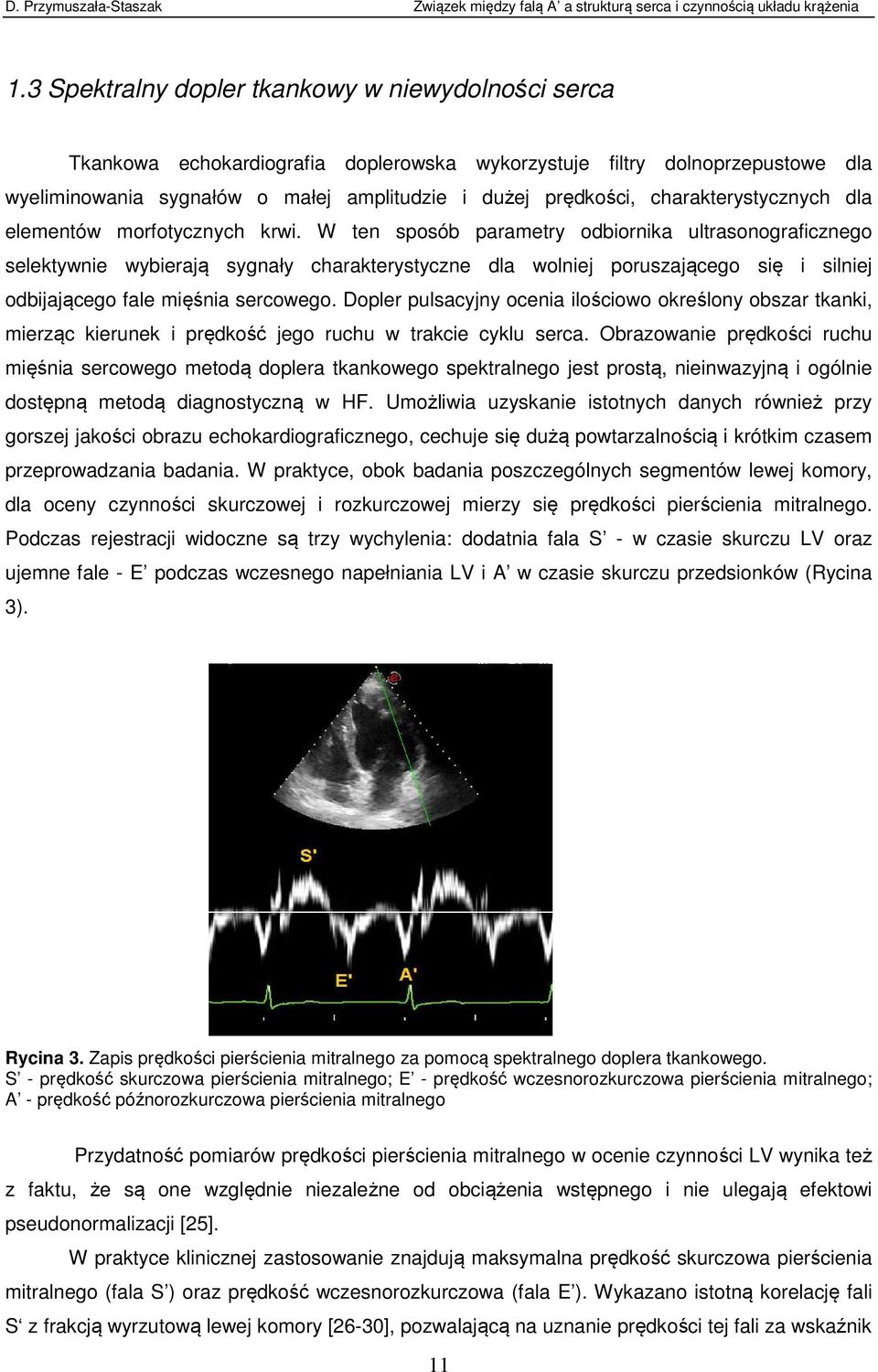W ten sposób parametry odbiornika ultrasonograficznego selektywnie wybierają sygnały charakterystyczne dla wolniej poruszającego się i silniej odbijającego fale mięśnia sercowego.