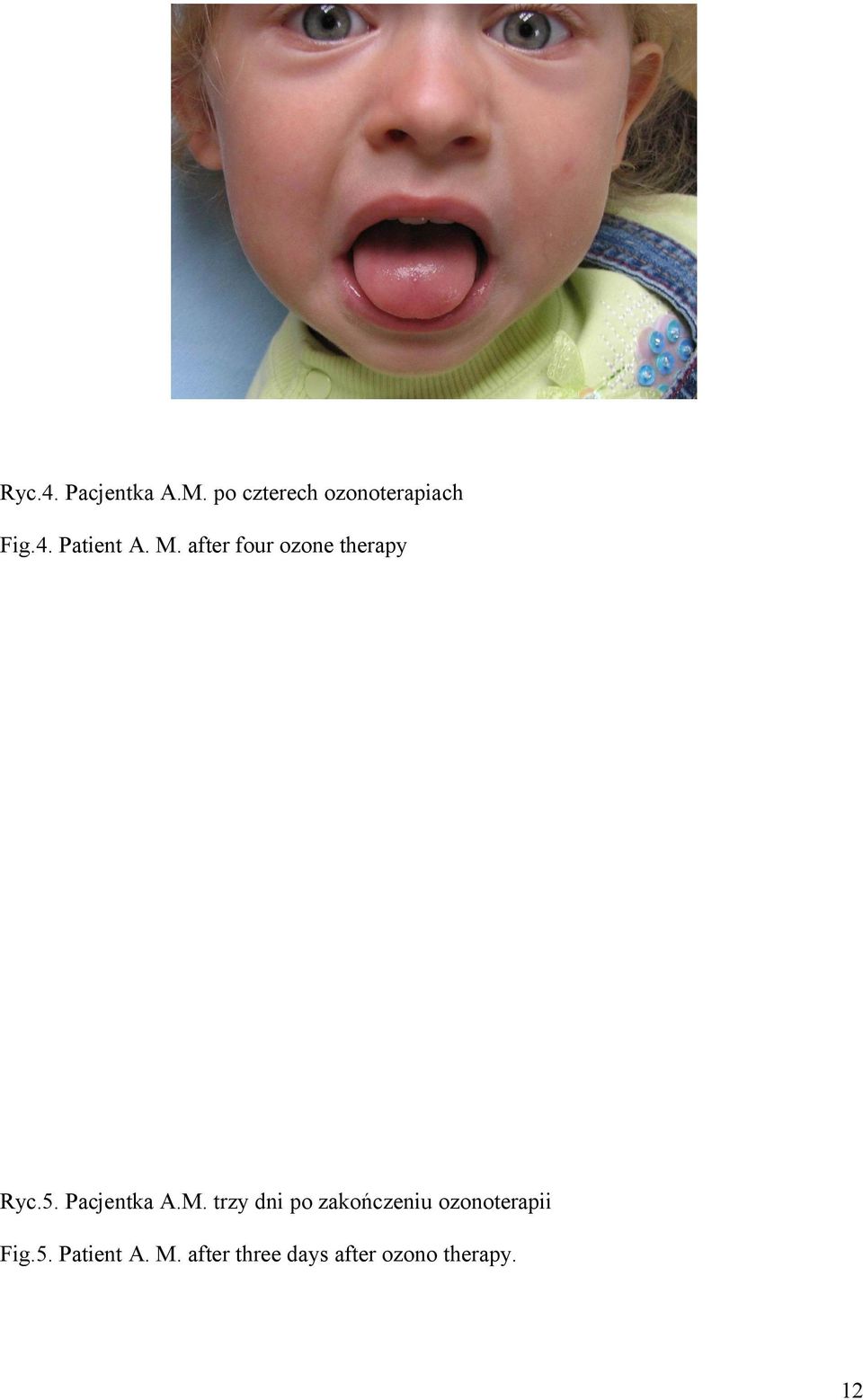 Pacjentka A.M.
