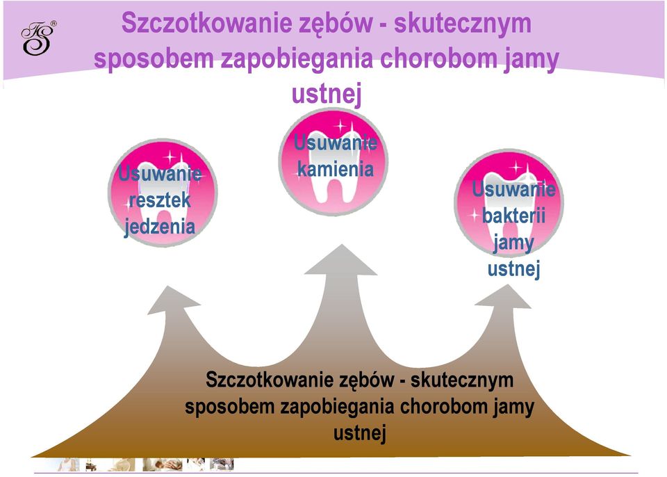kamienia Usuwanie bakterii jamy ustnej  chorobom jamy