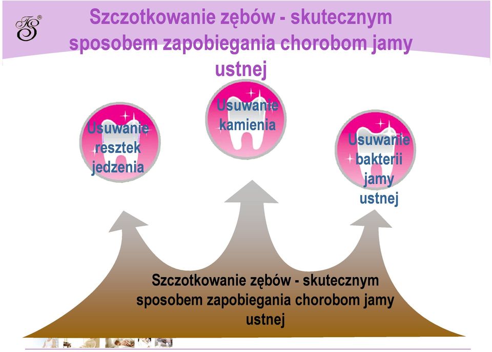 kamienia Usuwanie bakterii jamy ustnej  chorobom jamy