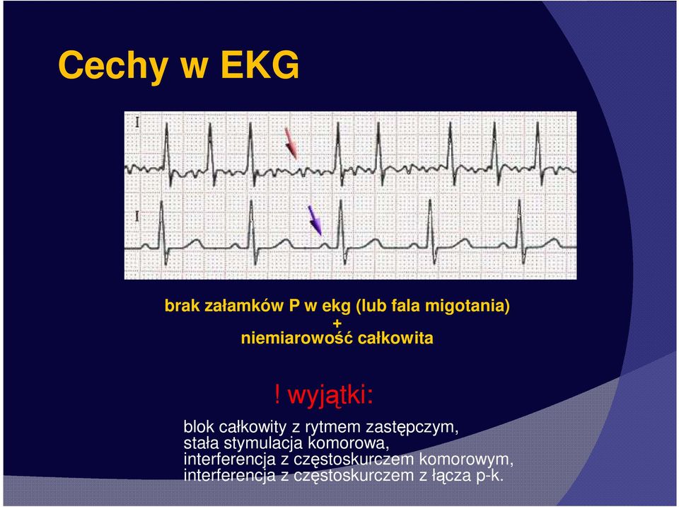 wyjątki: blok całkowity z rytmem zastępczym, stała