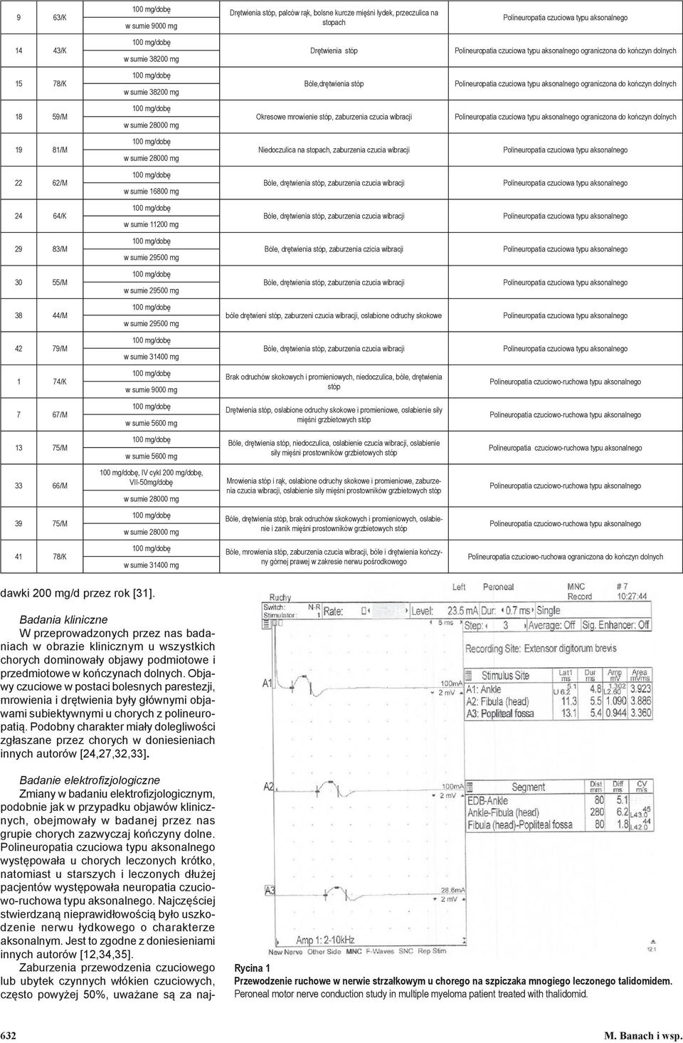 wibracji 22 62/M 24 64/K 29 83/M Bóle, drętwienia stóp, zaburzenia czicia wibracji 30 55/M 38 44/M bóle drętwieni stóp, zaburzeni czucia wibracji, osłabione odruchy skokowe 42 79/M w sumie 31400 mg 1