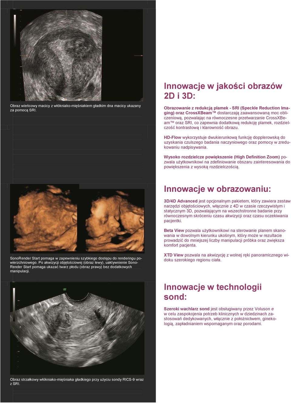 CrossXBeam oraz SRI, co zapewnia dodatkową redukcję plamek, rozdzielczość kontrastową i klarowność obrazu.