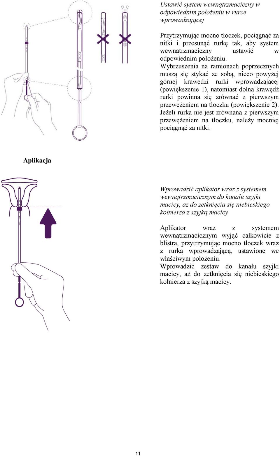 Wybrzuszenia na ramionach poprzecznych muszą się stykać ze sobą, nieco powyżej górnej krawędzi rurki wprowadzającej (powiększenie 1), natomiast dolna krawędź rurki powinna się zrównać z pierwszym