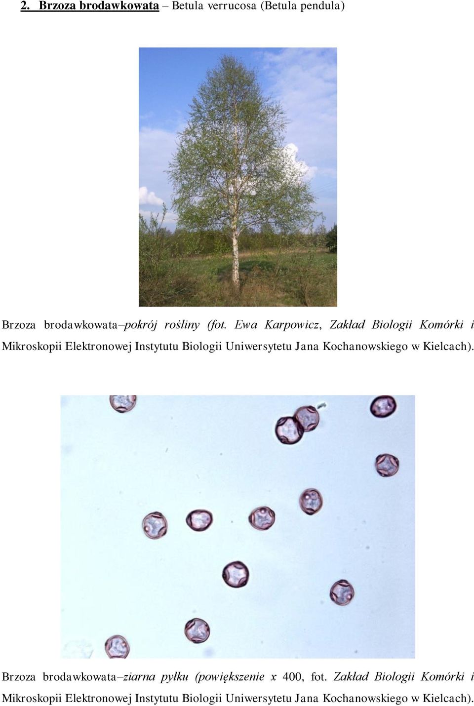 Jana Kochanowskiego w Kielcach). Brzoza brodawkowata ziarna pyłku (powiększenie x 400, fot.