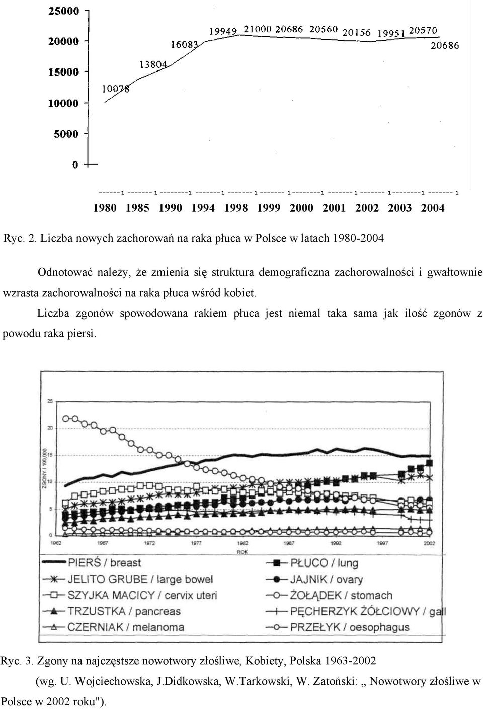 Liczba nowych zachorowań na raka płuca w Polsce w latach 1980-2004 Odnotować należy, że zmienia się struktura demograficzna zachorowalności i gwałtownie wzrasta