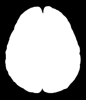 Komórka budująa mózg - NEURON * ~ 5 połązeń
