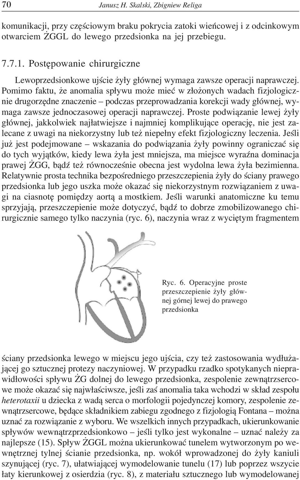 Pomimo faktu, e anomalia sp³ywu mo e mieæ w z³o onych wadach fizjologicznie drugorzêdne znaczenie podczas przeprowadzania korekcji wady g³ównej, wymaga zawsze jednoczasowej operacji naprawczej.
