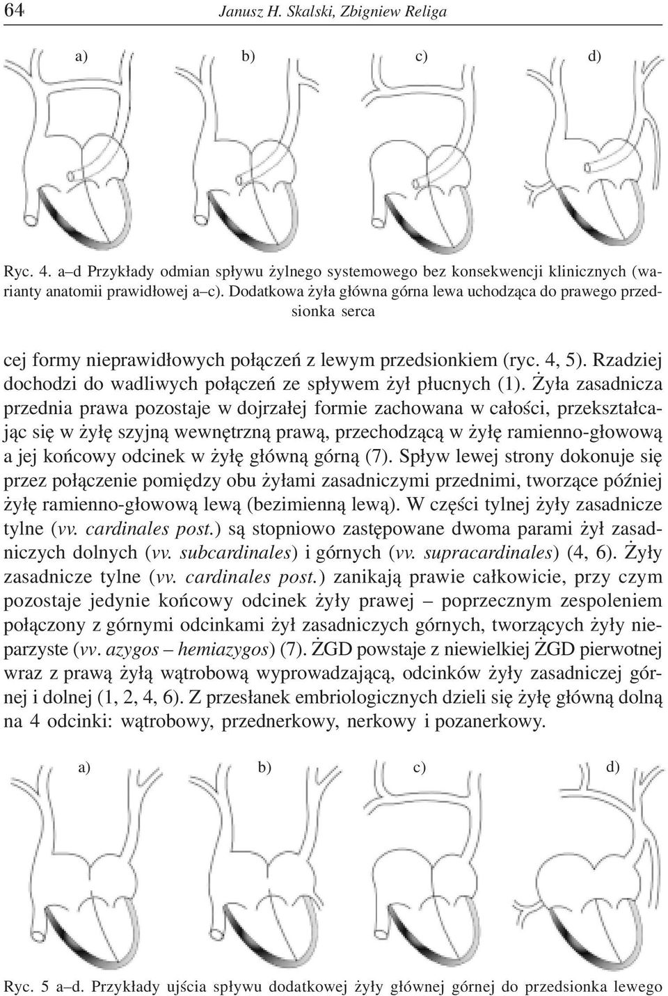 Rzadziej dochodzi do wadliwych po³¹czeñ ze sp³ywem y³ p³ucnych (1).