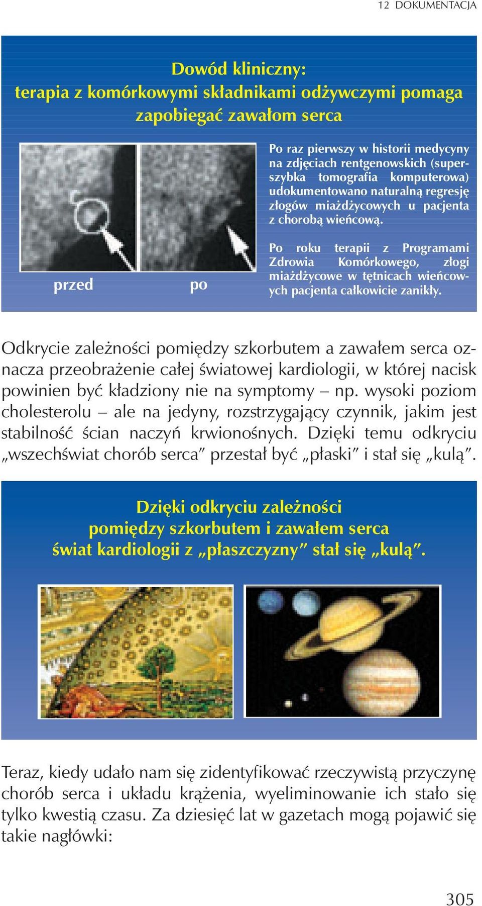 przed po Po roku terapii z Programami Zdrowia Komórkowego, z³ogi mia d ycowe w têtnicach wieñcowych pacjenta ca³kowicie zanik³y.