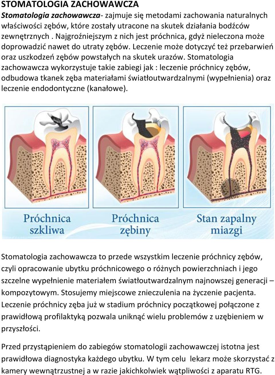 Stomatologia zachowawcza wykorzystuje takie zabiegi jak : leczenie próchnicy zębów, odbudowa tkanek zęba materiałami światłoutwardzalnymi (wypełnienia) oraz leczenie endodontyczne (kanałowe).