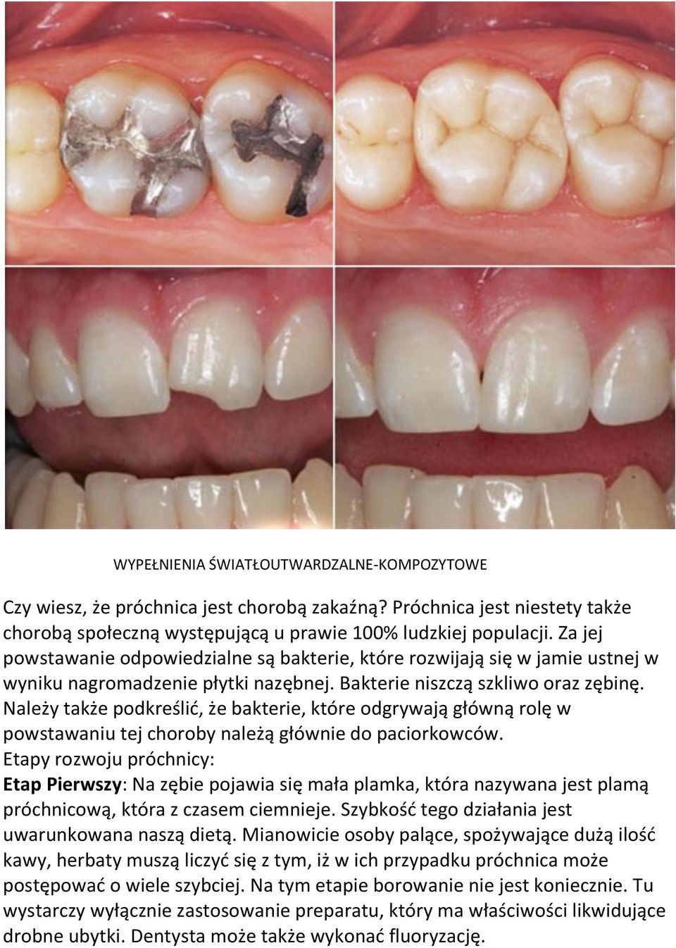 Należy także podkreślić, że bakterie, które odgrywają główną rolę w powstawaniu tej choroby należą głównie do paciorkowców.