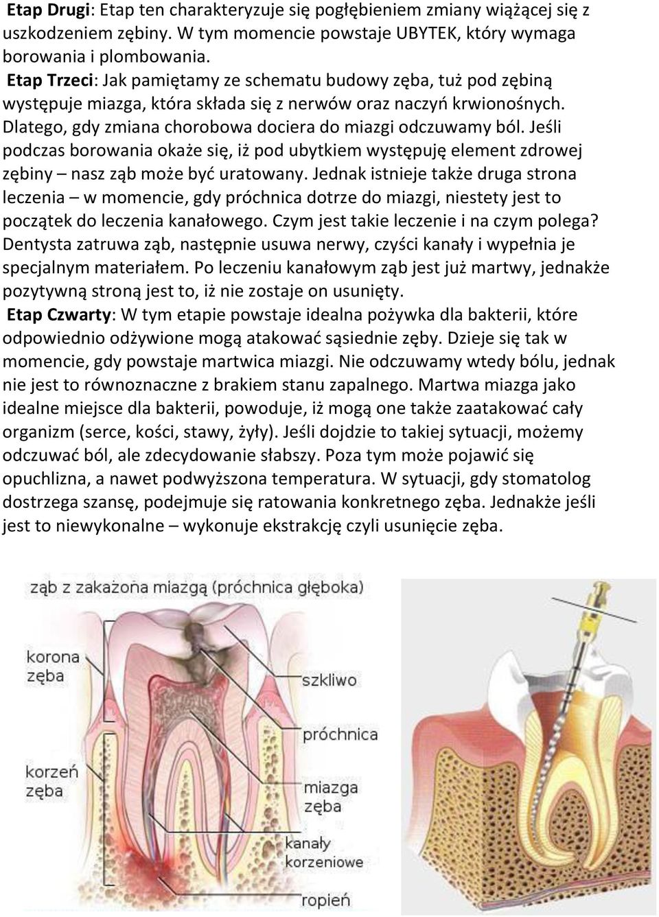 Jeśli podczas borowania okaże się, iż pod ubytkiem występuję element zdrowej zębiny nasz ząb może być uratowany.