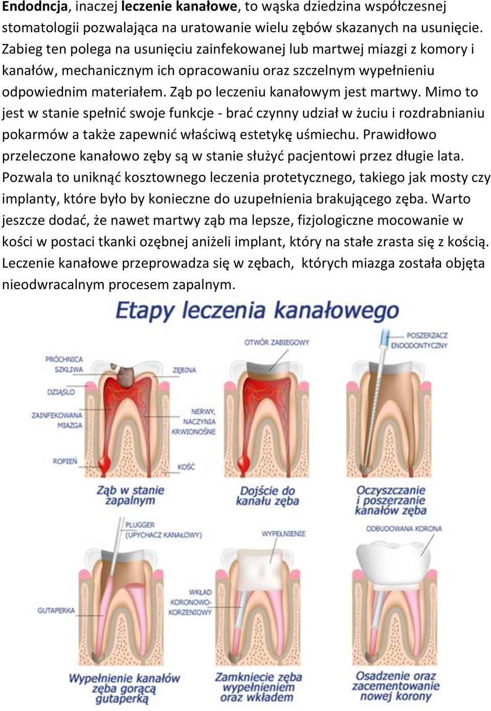 Ząb po leczeniu kanałowym jest martwy. Mimo to jest w stanie spełnić swoje funkcje - brać czynny udział w żuciu i rozdrabnianiu pokarmów a także zapewnić właściwą estetykę uśmiechu.