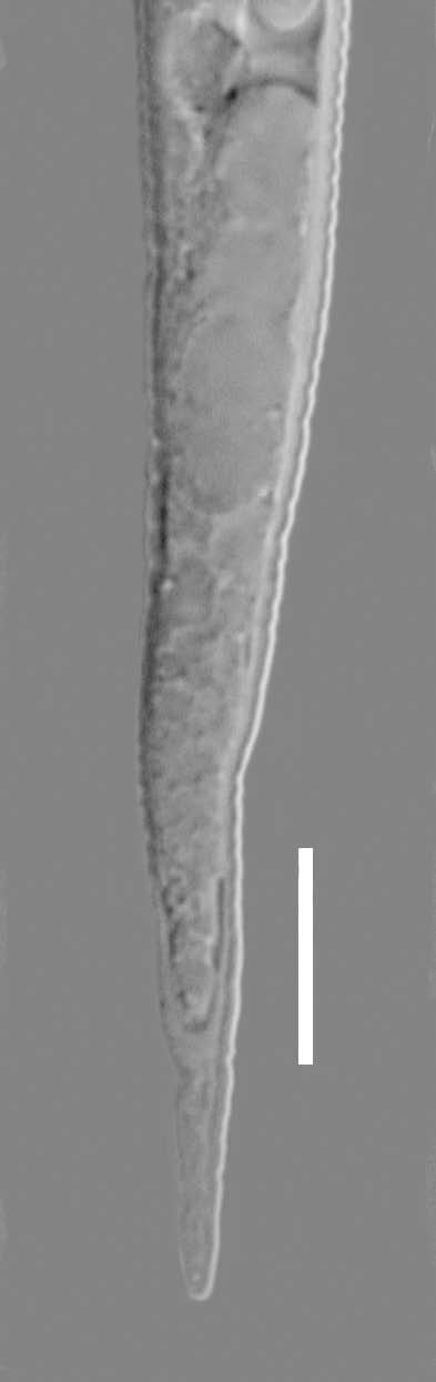 Instrukcja rozpoznawania gatunków z rodzaju Meloidogyne 11 (l) (m) (n) (o) (p) Fot.3b.