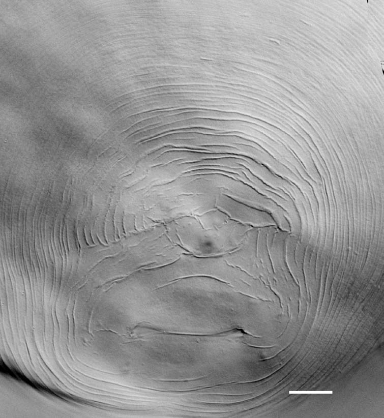 Instrukcja rozpoznawania gatunków z rodzaju Meloidogyne 9 (a) (b) (c) (d) (e) (f) (g) Fot.