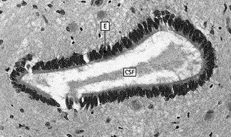 protoplazmatyczne włókniste Komórki mikrogleju (mezogleju) są odmianą makrofagów rezydującą w ośrodkowym układzie nerwowym pochodzenie szpikowe po aktywacji: - zmieniają kształt - migrują (np.