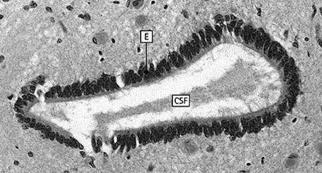 Ośrodkowy układ nerwowy Rdzeń kręgowy Istota szara: perykariony komórek nerwowych niezmielinizowane włókna nerwowe astrocyty protoplazmatyczne liczne naczynia krwionośne Istota biała: brak