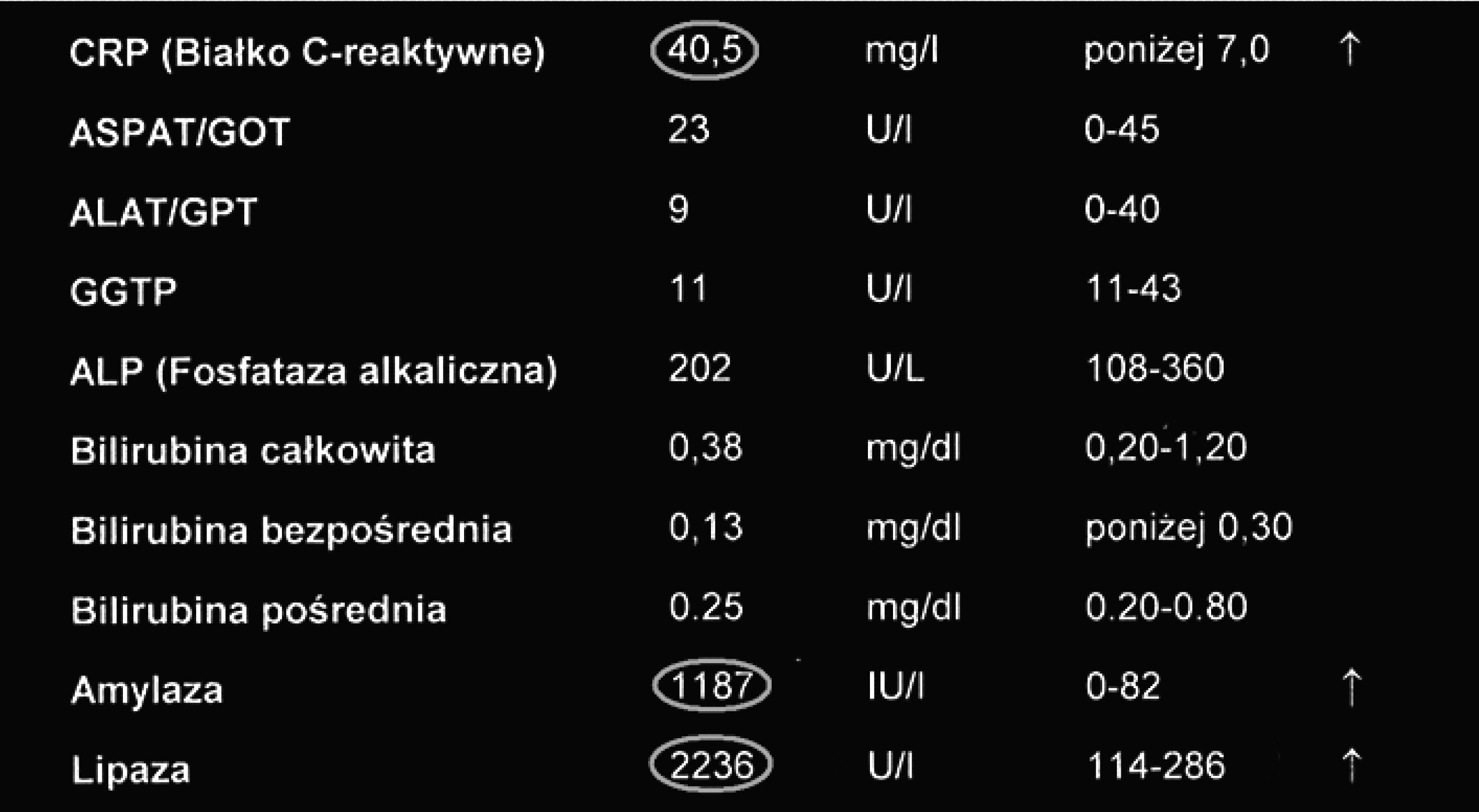 230 Tatiana Jamer, Barbara Iwańczak amoksycyliny z kwasem klawulanowym oraz cefuroksym, z powodu infekcji dróg oddechowych.