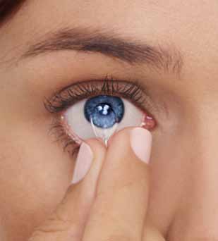 Postępowanie z przyklejoną (nieruchomą) soczewką Jeśli soczewka przykleja się do oka, specjalista może zalecić stosowanie kropli nawilżających.