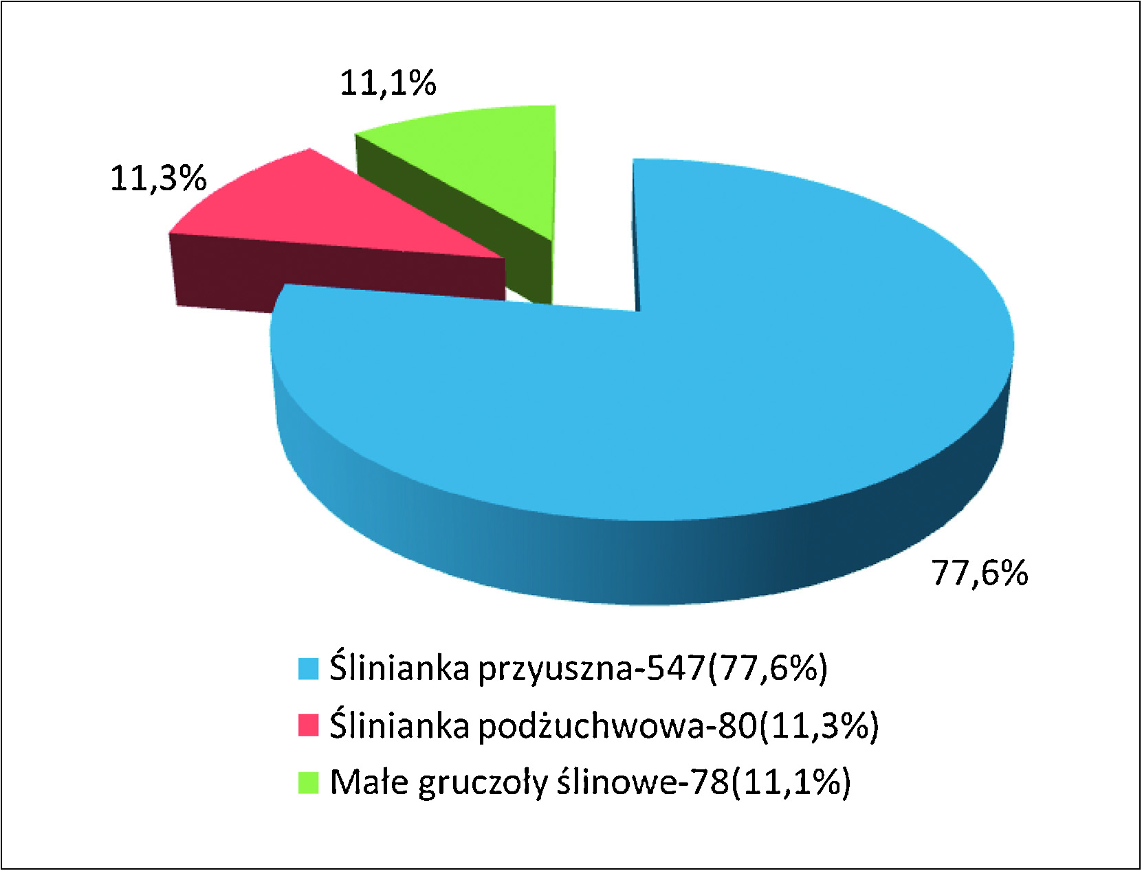 156 otolaryngologia polska 67 (2013) 154 163 Tabela I Analiza płci w grupie pacjentów z nowotworami niezłośliwymi i złośliwymi gruczołów ślinowych (n = 699) Table I Analysis of sex of the patients