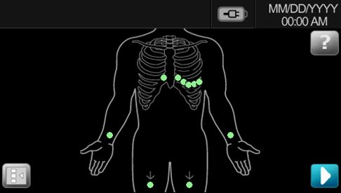 Instrukcja obsługi Badania EKG 25 Wykonywanie badania EKG 1. Podłącz odprowadzenia do pacjenta. Migające kropki na ekranie stanu odprowadzenia wskazują odprowadzenie słabo dołączone lub odłączone.