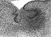 Ozębna Rozwój narządu zębowego Stadia rozwojowe: pączka czapeczki dzwonka Ząb rozwija się na styku dwóch tkanek (ektodermy i neuromezenchymy), które wzajemnie na siebie wpływają poprzez sterowanie