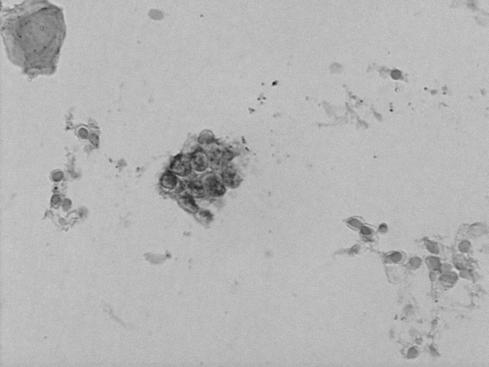 Endokrynologia Polska/Polish Journal of Endocrinology 2009; 60 (3) Figure 1.