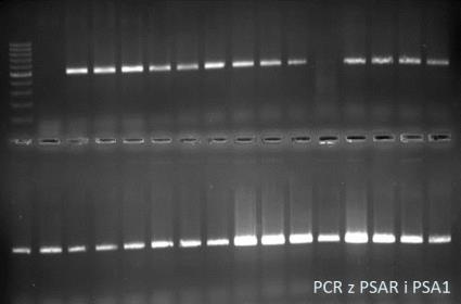 Schemat identyfikacji Clavibacter michiganensis ssp. sepedonicus IZOLAT Test IF (przeciwciała poliklonalne) pozytywny negatywny Izolat inny niż C. m. subsp.