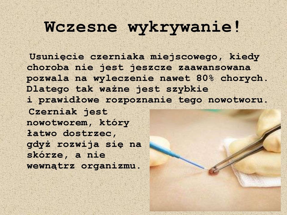 pozwala na wyleczenie nawet 80% chorych.