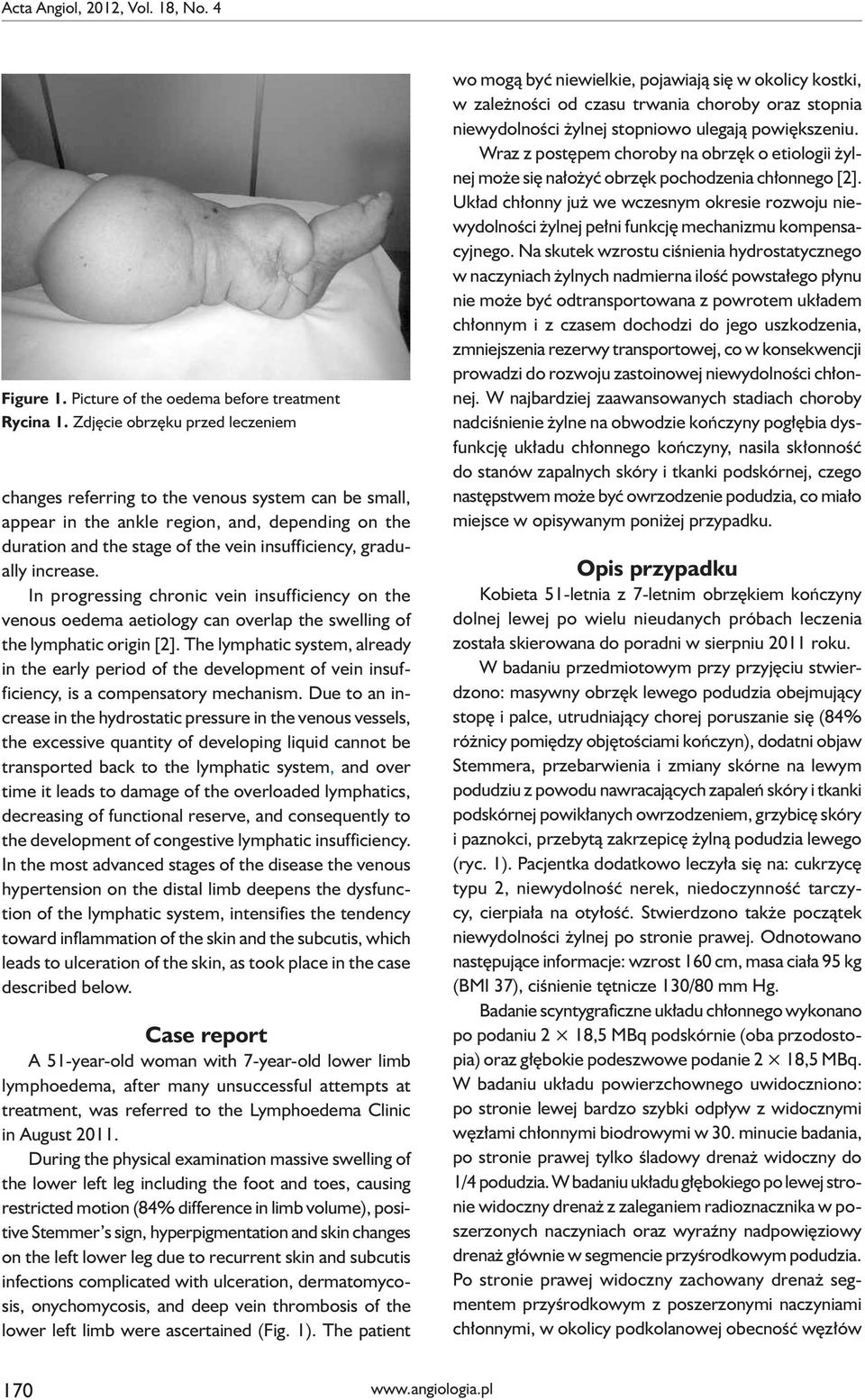 increase. In progressing chronic vein insufficiency on the venous oedema aetiology can overlap the swelling of the lymphatic origin [2].