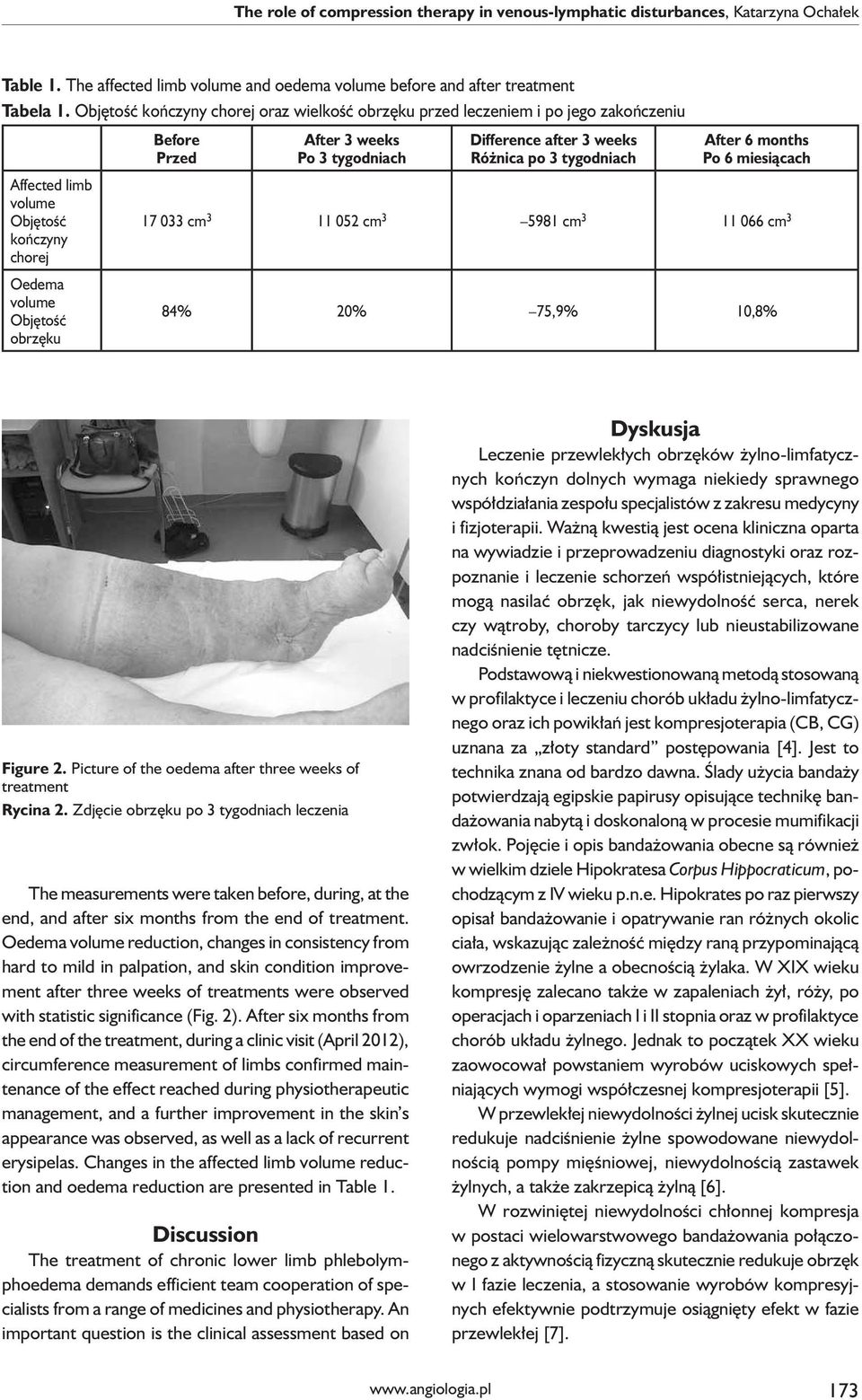 tygodniach Difference after 3 weeks Różnica po 3 tygodniach After 6 months Po 6 miesiącach 17 033 cm 3 11 052 cm 3 5981 cm 3 11 066 cm 3 84% 20% 75,9% 10,8% Figure 2.