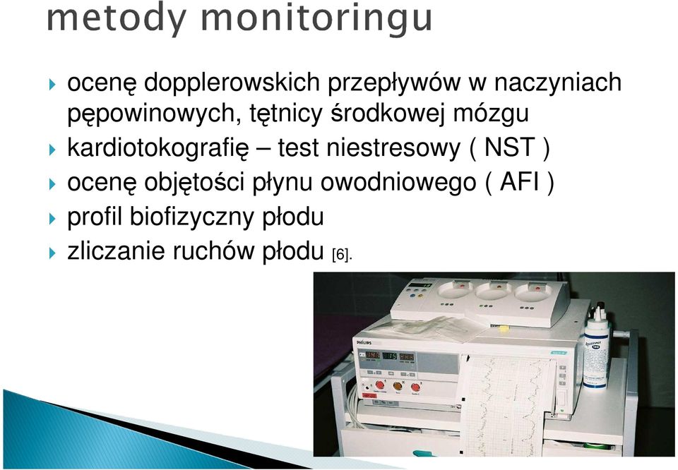 test niestresowy ( NST ) ocenę objętości płynu