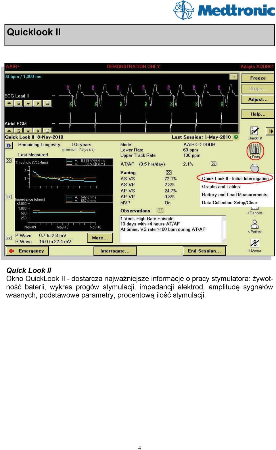 baterii, wykres progów stymulacji, impedancji elektrod,