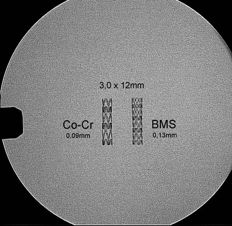 1042 Paweł Buszman et al. A B Figure I. The structure of the Kos stent These advantages justify more common interest in the use of stents based on Co-Cr alloys.