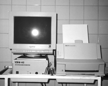 Udar Mózgu 2002, tom 4, nr 1 powiada obrazowi klinicznemu (np. w zawale złośliwym mózgu) [1 3, 5].