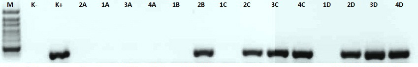242 M. Komorowski i inni Nr 3 Ryc. 1 Elektroforegram obrazujący rozdział produktów reakcji PCR wykonanej z użyciem supernatanó z nad hodowli Huh_7.5 24h po przeprowadzonej lipofekcji.